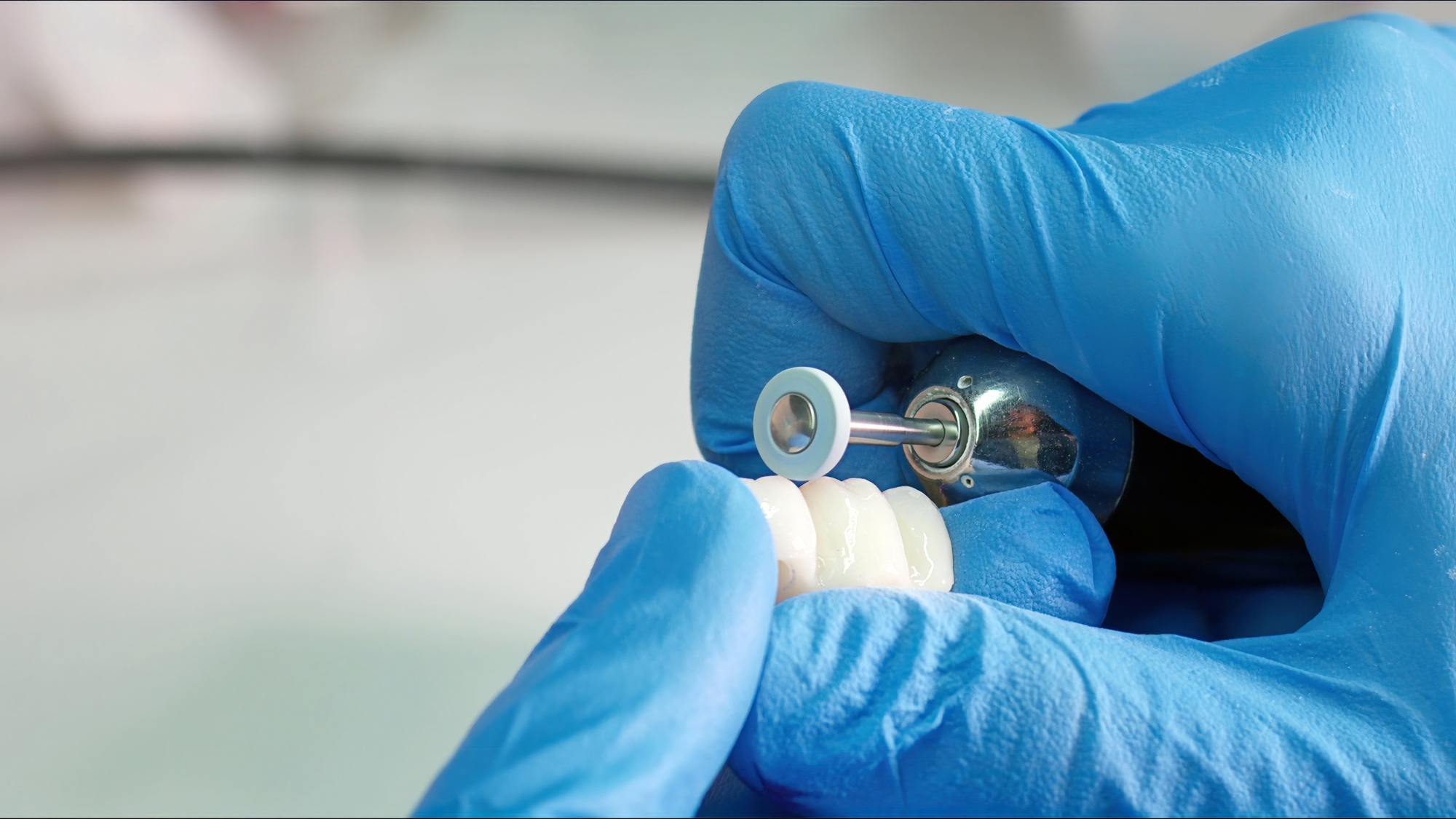 Zirconium porcelain and implant studies in the Dental Laboratory
